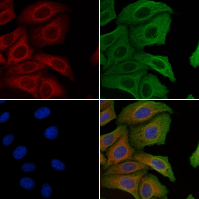 RPL10A Antibody in Immunocytochemistry (ICC/IF)