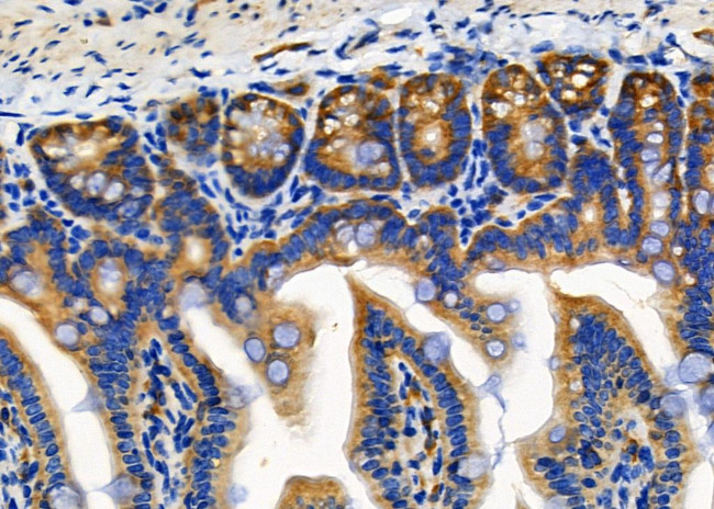 RPL18 Antibody in Immunohistochemistry (Paraffin) (IHC (P))