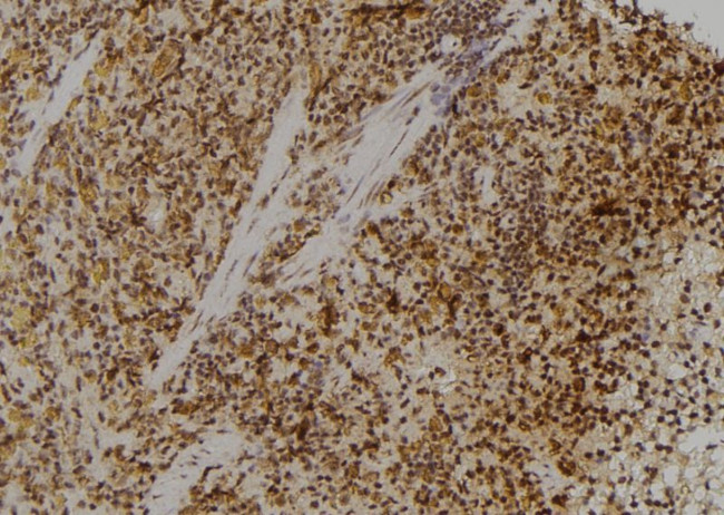 RPL23 Antibody in Immunohistochemistry (Paraffin) (IHC (P))