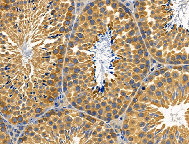 RPL26L1 Antibody in Immunohistochemistry (Paraffin) (IHC (P))