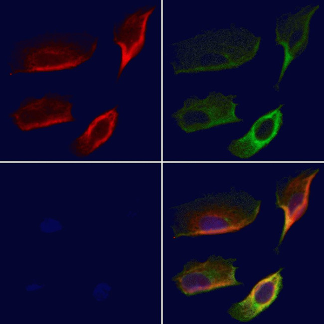RPL28 Antibody in Immunocytochemistry (ICC/IF)