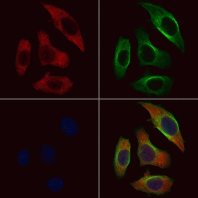 RPL36 Antibody in Immunocytochemistry (ICC/IF)