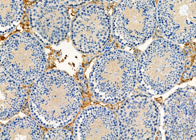 LPCAT2 Antibody in Immunohistochemistry (Paraffin) (IHC (P))