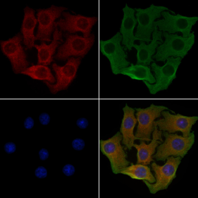ARFGAP1 Antibody in Immunocytochemistry (ICC/IF)