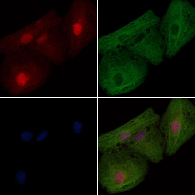 ARL2BP Antibody in Immunocytochemistry (ICC/IF)