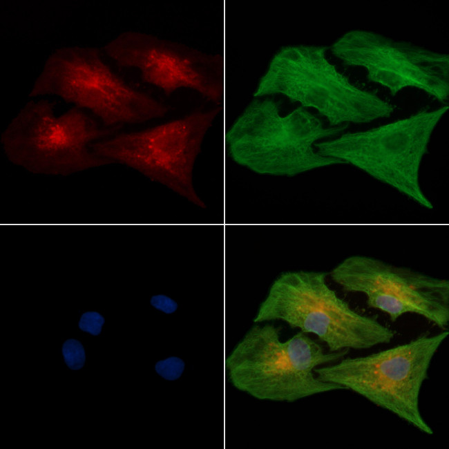 ALDH1B1 Antibody in Immunocytochemistry (ICC/IF)