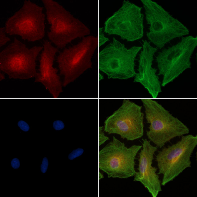 Amphiphysin Antibody in Immunocytochemistry (ICC/IF)