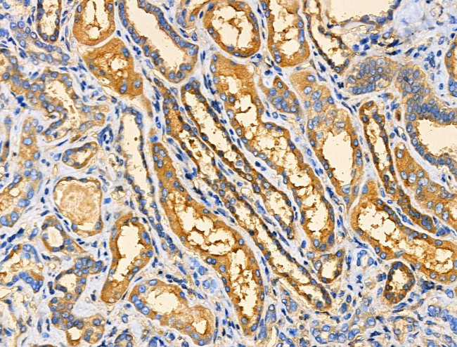 APBB2 Antibody in Immunohistochemistry (Paraffin) (IHC (P))