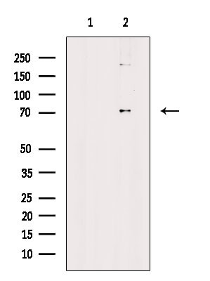 ALS2CR11 Antibody in Western Blot (WB)
