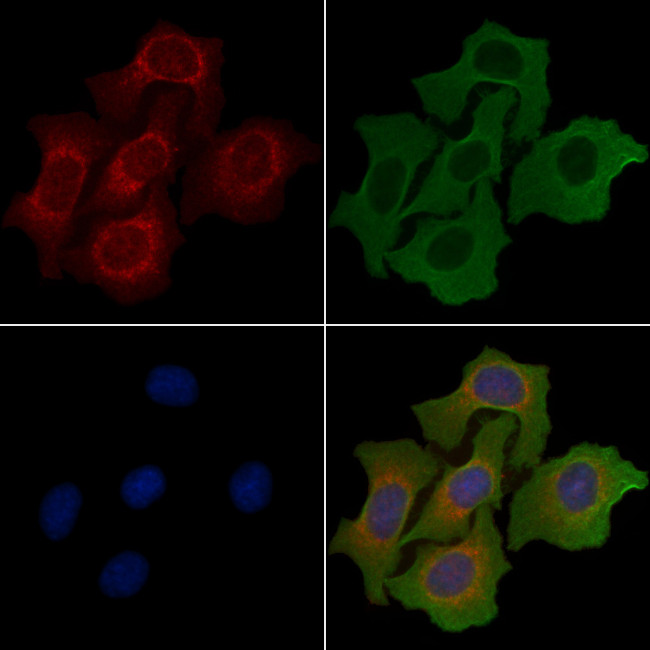 AIG1 Antibody in Immunocytochemistry (ICC/IF)