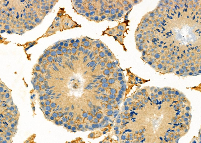 Apolipoprotein L1 Antibody in Immunohistochemistry (Paraffin) (IHC (P))