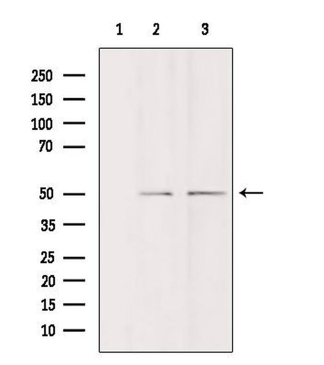 DDX19B Antibody in Western Blot (WB)