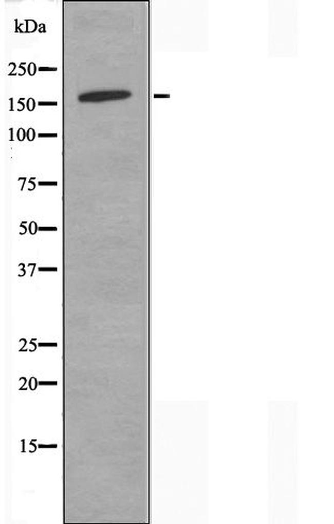 DHX8 Antibody in Western Blot (WB)