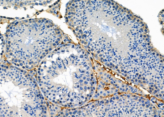 BNIP2 Antibody in Immunohistochemistry (Paraffin) (IHC (P))