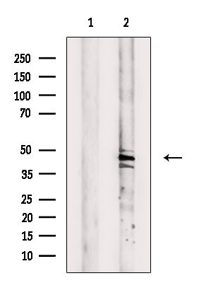 GCNT6 Antibody in Western Blot (WB)