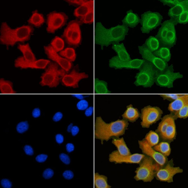 SLC27A5 Antibody in Immunocytochemistry (ICC/IF)
