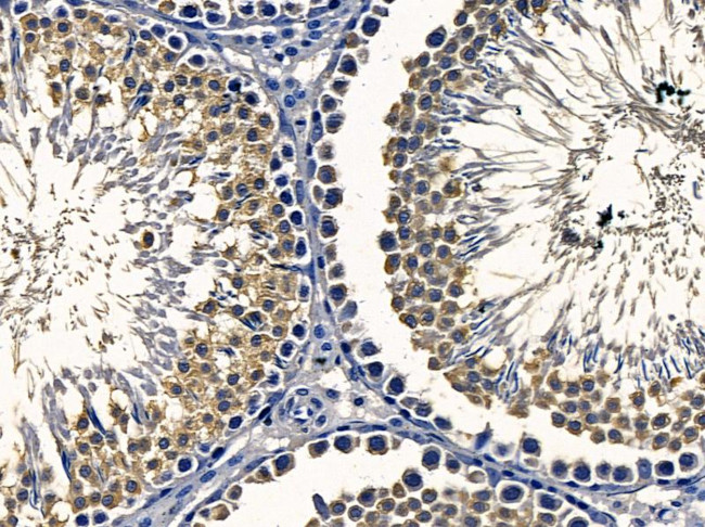 BAIAP2L2 Antibody in Immunohistochemistry (Paraffin) (IHC (P))