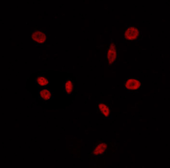 BAZ2A Antibody in Immunocytochemistry (ICC/IF)