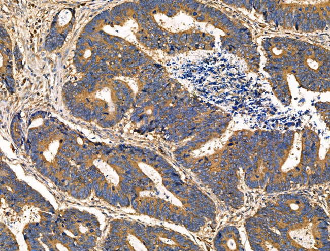 PNPLA8 Antibody in Immunohistochemistry (Paraffin) (IHC (P))
