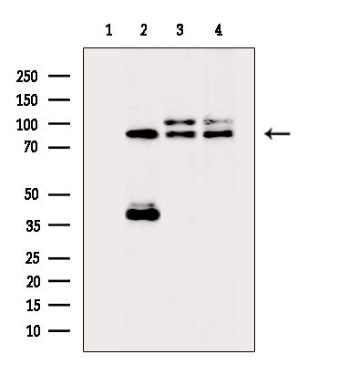 PNPLA8 Antibody in Western Blot (WB)