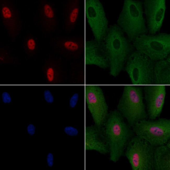 Calpain 12 Antibody in Immunocytochemistry (ICC/IF)