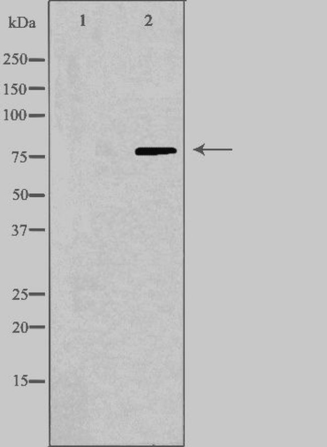 Calpain 9 Antibody in Western Blot (WB)
