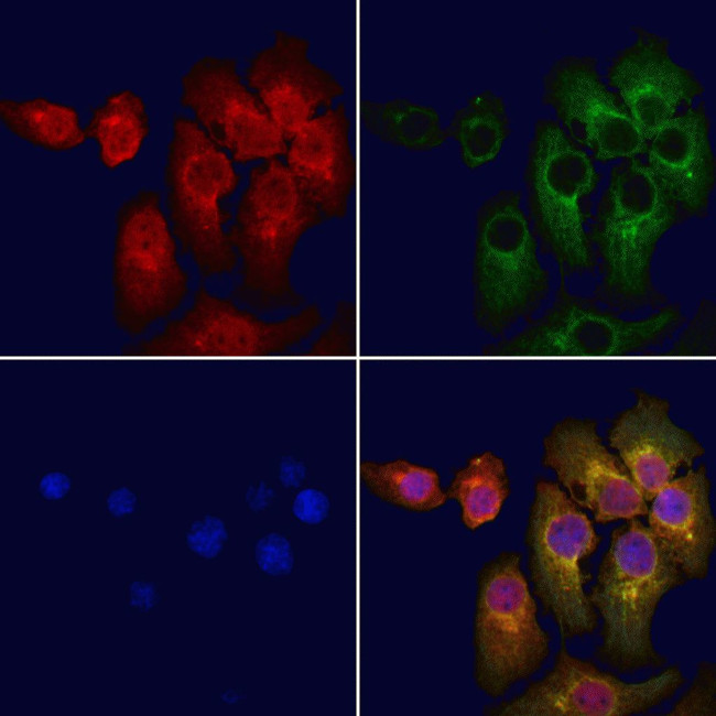 ARPP21 Antibody in Immunocytochemistry (ICC/IF)