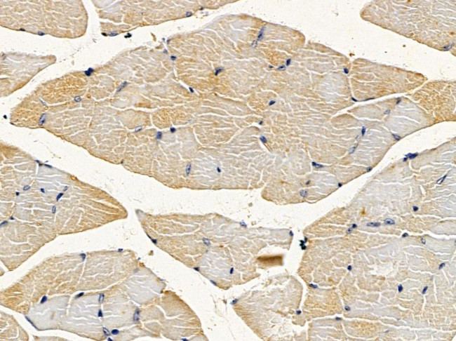 Carbonic Anhydrase III Antibody in Immunohistochemistry (Paraffin) (IHC (P))