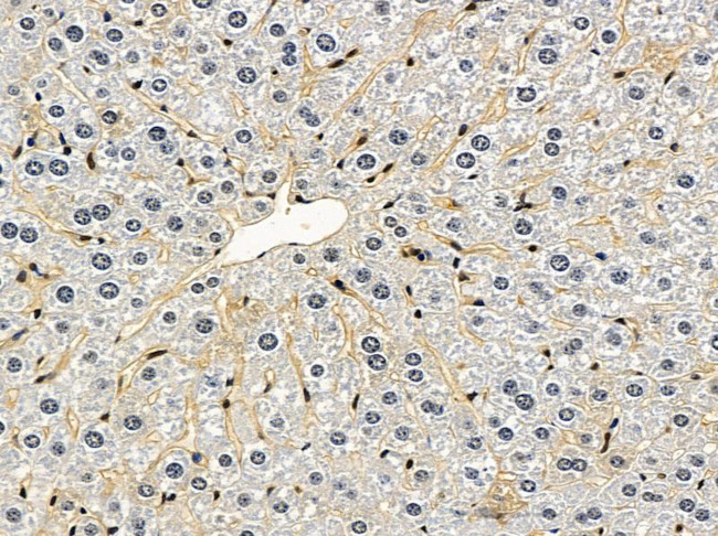 CPN1 Antibody in Immunohistochemistry (Paraffin) (IHC (P))