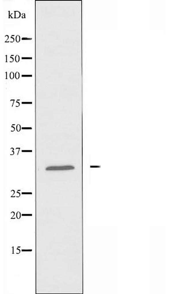CGREF1 Antibody in Western Blot (WB)