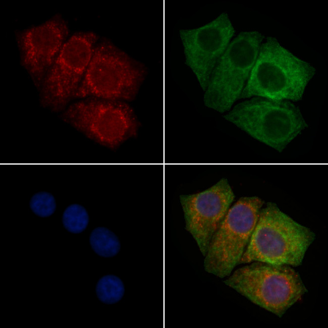 CEP170 Antibody in Immunocytochemistry (ICC/IF)