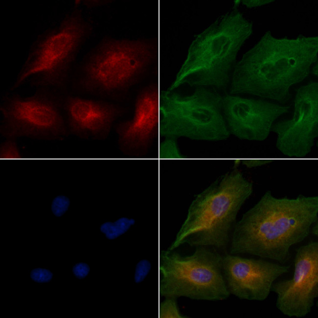 CEP76 Antibody in Immunocytochemistry (ICC/IF)