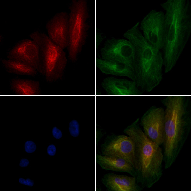 CEP78 Antibody in Immunocytochemistry (ICC/IF)