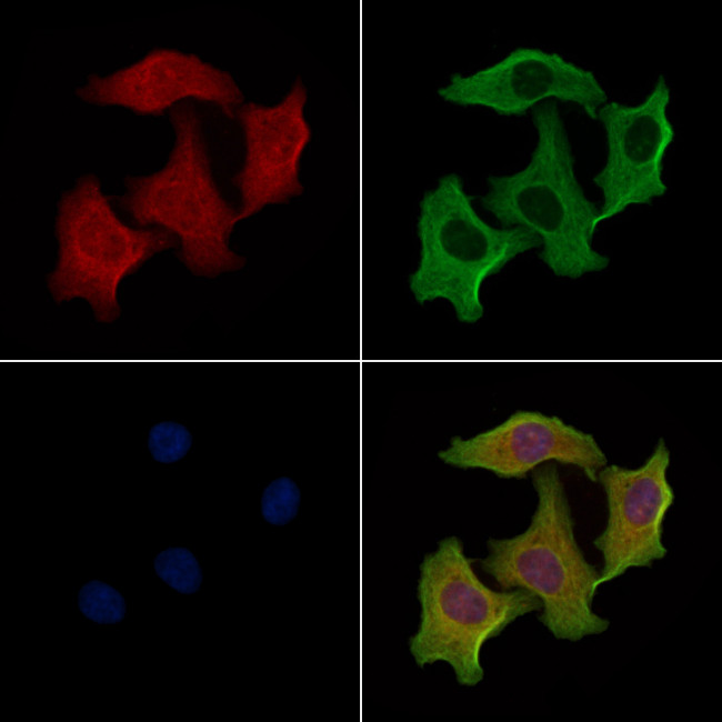 Cerebellin 2 Antibody in Immunocytochemistry (ICC/IF)