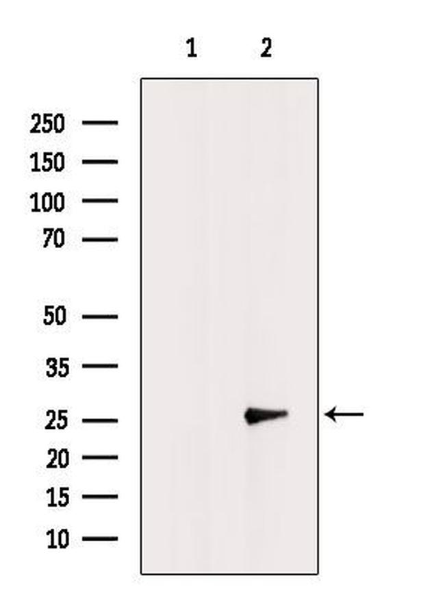 CMTM6 Antibody in Western Blot (WB)