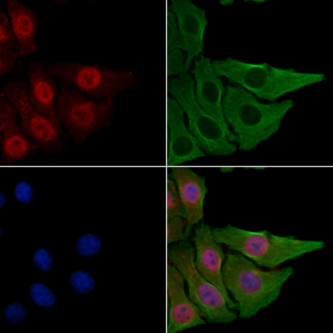 CSTF2T Antibody in Immunocytochemistry (ICC/IF)
