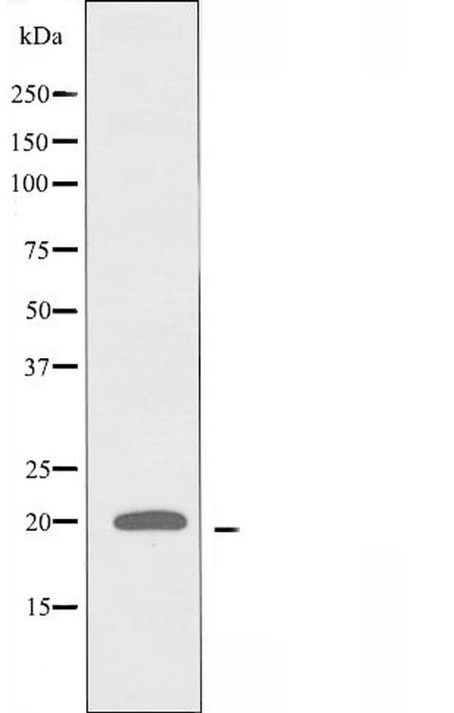 COPZ1 Antibody in Western Blot (WB)