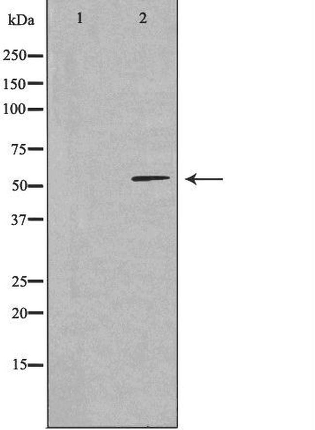 CCDC102A Antibody in Western Blot (WB)