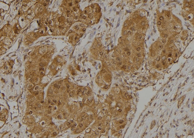 C18orf14 Antibody in Immunohistochemistry (Paraffin) (IHC (P))