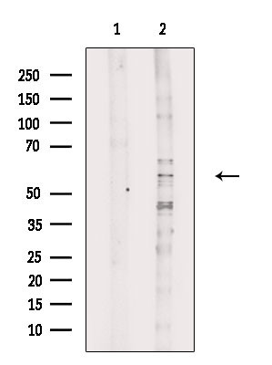 BEND4 Antibody in Western Blot (WB)