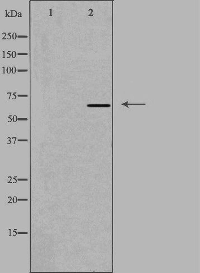 Complement Factor I Antibody in Western Blot (WB)