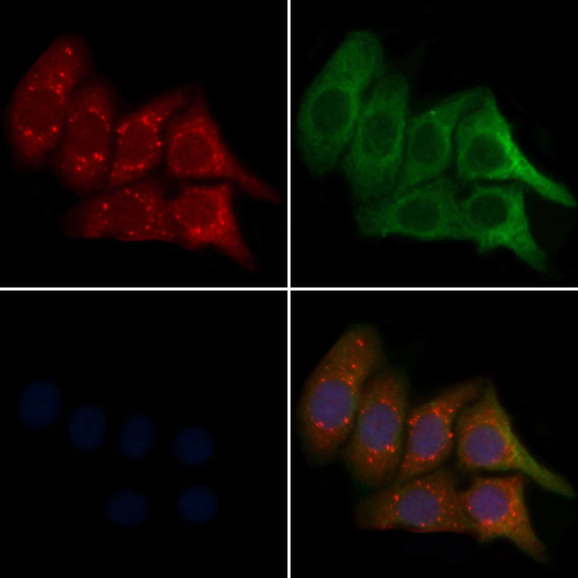 CST11 Antibody in Immunocytochemistry (ICC/IF)
