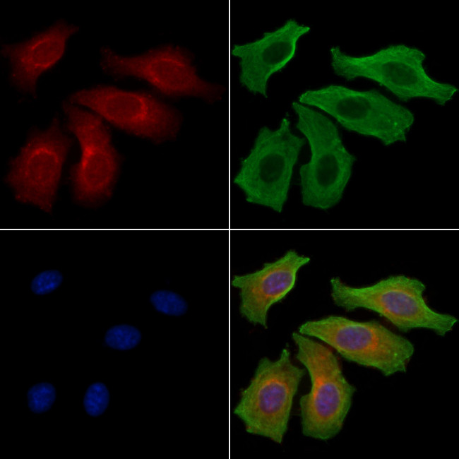 NT5C1A Antibody in Immunocytochemistry (ICC/IF)