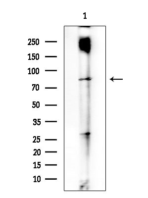 CCP2 Antibody in Western Blot (WB)