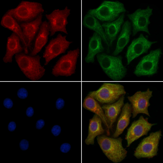 CRMP3 Antibody in Immunocytochemistry (ICC/IF)