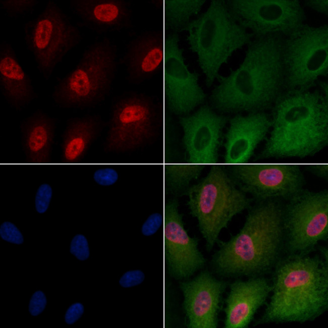 TdT Antibody in Immunocytochemistry (ICC/IF)