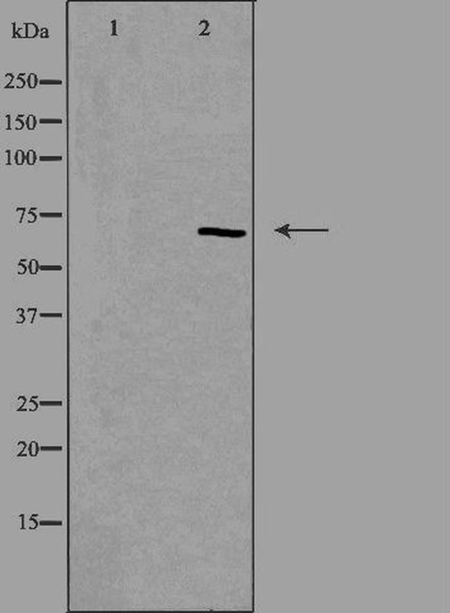 TESK1 Antibody in Western Blot (WB)