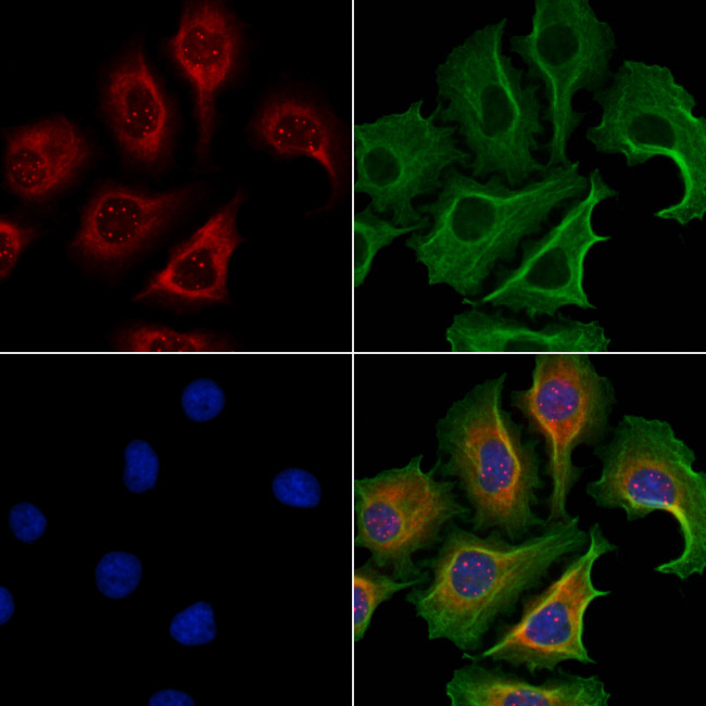DNAL1 Antibody in Immunocytochemistry (ICC/IF)