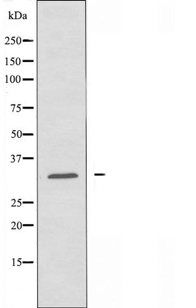 RNF144A Antibody in Western Blot (WB)