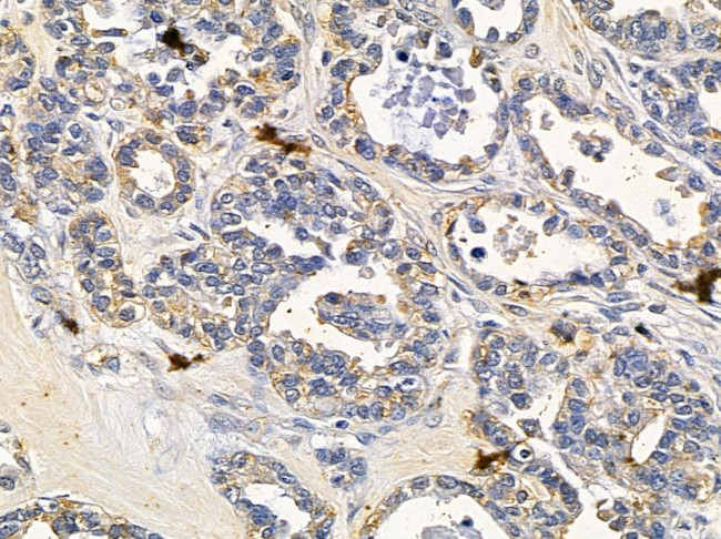 GFM2 Antibody in Immunohistochemistry (Paraffin) (IHC (P))